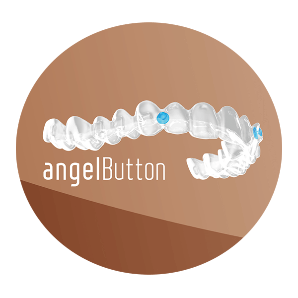 Benefits of Angel Aligners